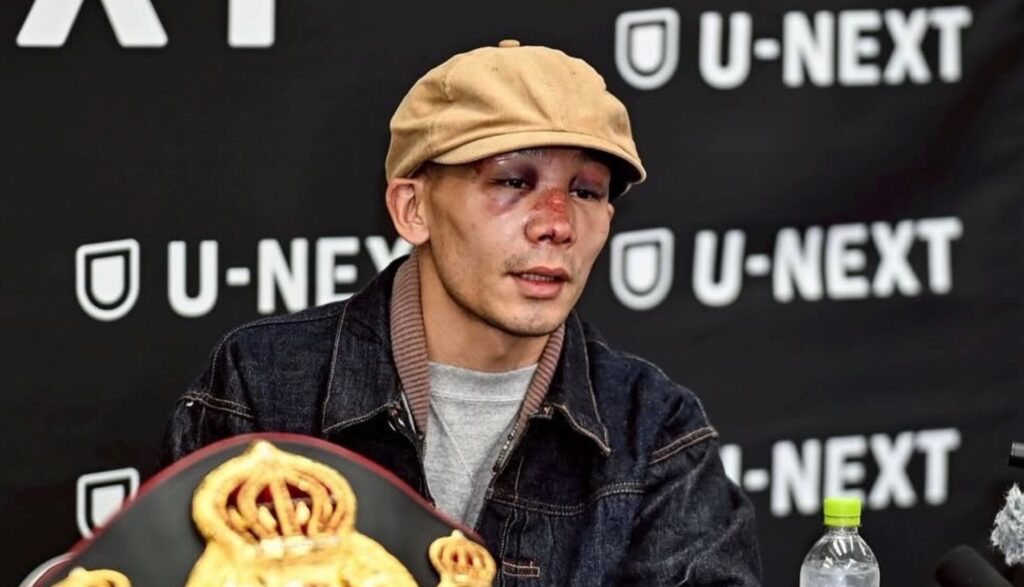 堤聖也選手、死闘の代償と次なる決意 ドネア戦の翌日に4時間の大手術「この経験は一生の財産」