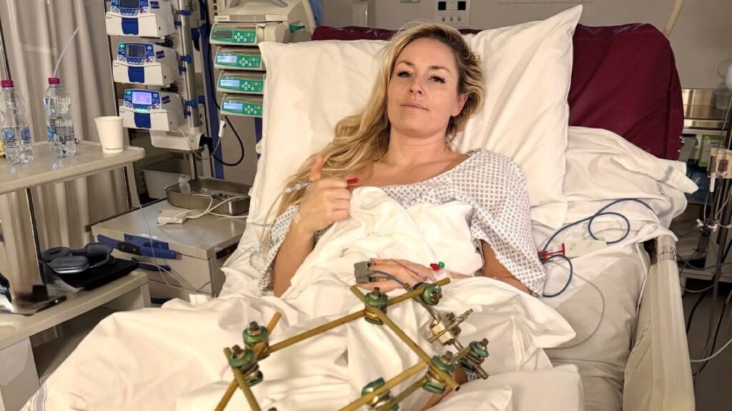 「スキーの女帝」リンゼイ・ボン 3度目の手術を報告 大事故から懸命の回復「一歩ずつ前へ」