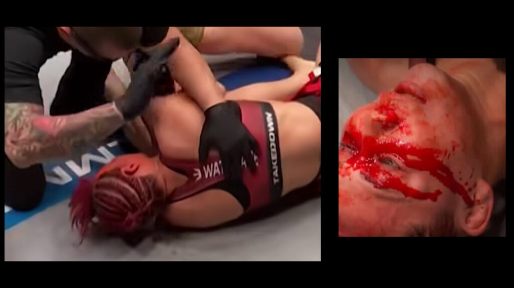 PFL参戦の渡辺華奈選手が欧州王者の“完成度”に屈す・・・流血TKO敗戦が示した現在地